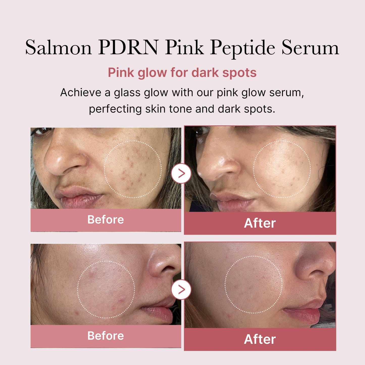 Medicube - PDRN Pink Peptide Serum