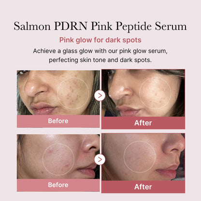 Medicube - PDRN Pink Peptide Serum